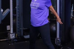 Lipedema Challenge