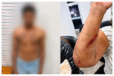 Mulher &eacute; esfaqueada durante viol&ecirc;ncia dom&eacute;stica em Atibaia