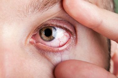 O impacto da chegada do inverno na saúde ocular