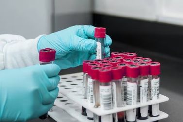 Dengue faz Secretaria de Saúde suspender exames eletivos de sangue em Brumadinho