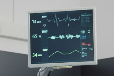 Buritama abre preg&atilde;o eletr&ocirc;nico para compra de ecocardi&oacute;grafo