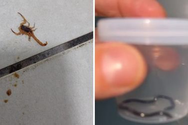 Escorpião e filhote de cobra são encontrados na UPA Jacaré 