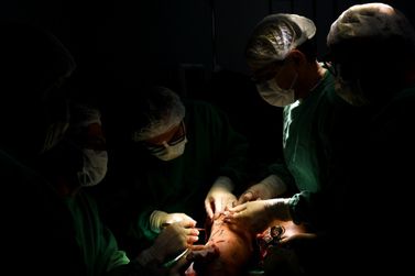 Mutirão de Procedimentos Vasculares beneficia primeira paciente em Campos