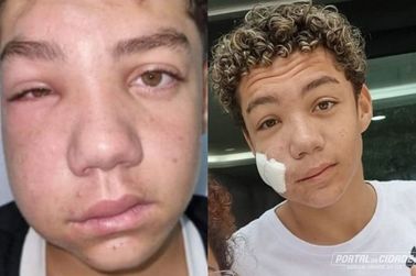 Garoto com doen&ccedil;a rara no rosto precisa de ajuda no tratamento
