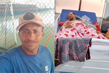 V&iacute;tima de acidente de moto no povoado Deserto faz campanha para tratamento