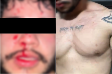 Suspeito de agress&atilde;o contra ex-namorada apresenta sua vers&atilde;o e nega acusa&ccedil;&otilde;es