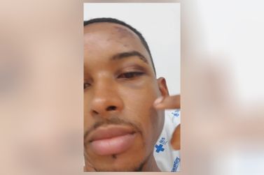 Rafael Cruz mostra perna p&oacute;s-cirurgia e refor&ccedil;a pedido de apoio em vaquinha