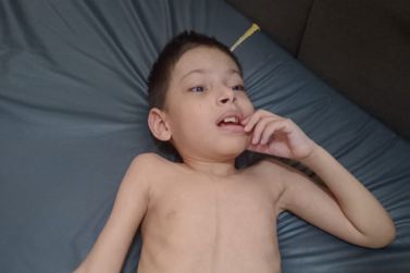 Ap&oacute;s 26 cirurgias, Victor Gabriel de Tapira precisa de nova cirurgia urgente