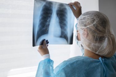 Secretaria da Saúde de Gramado alerta sobre prevenção e combate à Tuberculose