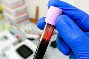 Guaratuba registra primeiro caso de dengue do ano em novo boletim