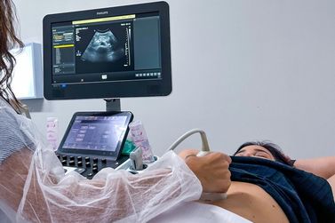 Policlínica de Ipatinga recebe novos equipamentos médicos