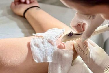 Tim&oacute;teo capacita profissionais de sa&uacute;de e amplia oferta de m&eacute;todos contraceptivos no SUS