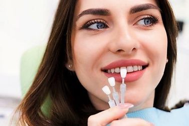 Conheça os benefícios das facetas dentais na OdontoCompany Jacarezinho 
