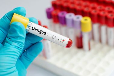 Primeiro boletim da dengue de 2024 confirma 9.189 casos da doença no Paraná