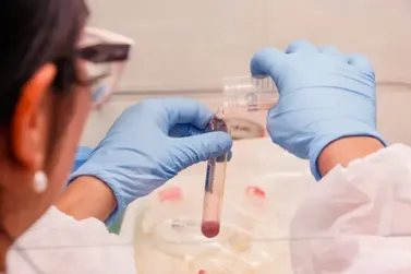 Pesquisa da USP associa exame de sangue e IA para diagnosticar hansen&iacute;ase precocemente