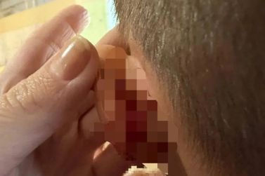 Padrasto &eacute; preso em Siqueira Campos ap&oacute;s orelha de enteado de 4 anos ser rasgada