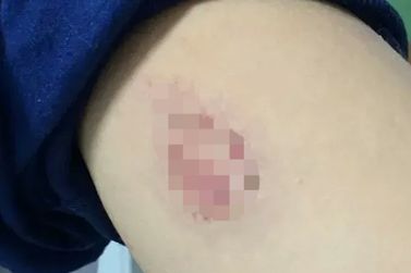 Mulher invade escola e agride estudante de 13 anos dentro de sala de aula