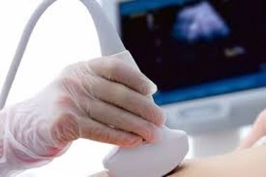 Tecnologia de bolso acelera diagn&oacute;stico de doen&ccedil;as femininas no interior de MT