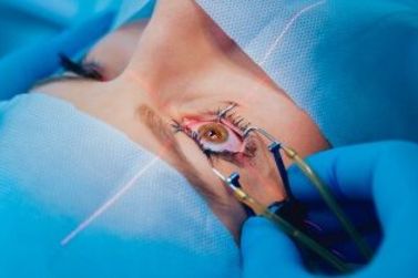 Santa Casa passa a oferecer maior quantidade de cirurgias oftalmológicas