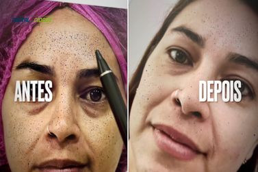 Dermacode revoluciona avalia&ccedil;&atilde;o da pele em poucos minutos