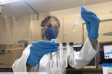 Pesquisadora da UEM &eacute; pioneira nos estudos de tuberculose em Maring&aacute;