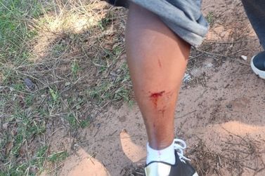 Mulher fica ferida ap&oacute;s ser atacada por cachorro em Vila Rural de Paranava&iacute;