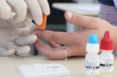 Sesab desmente surto de HIV/Aids entre jovens na Bahia e divulga dados oficiais