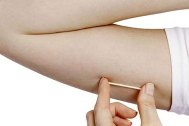 M&eacute;dicos da rede municipal participam de capacita&ccedil;&atilde;o sobre implante contraceptivo