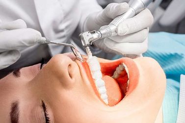 Limpeza Dental: Prevenção e Saúde Bucal