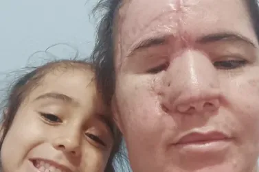 Jovem de Surubim cria campanha para custear tratamento contra c&acirc;ncer