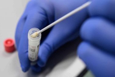Sobe para 19 os casos confirmados do novo coronav&iacute;rus em Cianorte