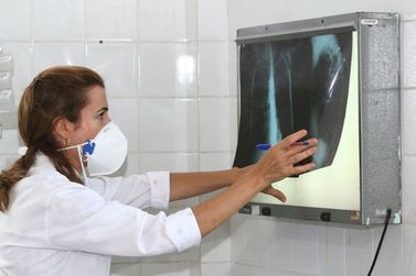 Planalto Norte tem segunda maior taxa de cura da tuberculose em SC