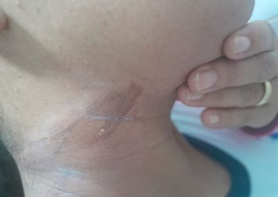 V&iacute;tima foi atingida no pesco&ccedil;o e, por pouco, n&atilde;o sofreu uma queda do ve&iacute;culo