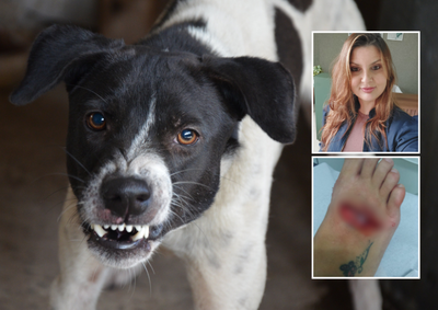 Relato mostra como c&atilde;es sem conten&ccedil;&atilde;o podem provocar ferimentos f&iacute;sicos e traumas emocionais duradouros; debate ganhou repercuss&atilde;o jornalista ser atacado