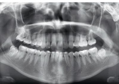O resultado preciso e imagem de alta qualidade &eacute; fundamental para que o dentista possa realizar diagn&oacute;stico preciso ou fazer o plano de tratamento