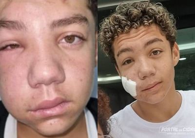 Humilde, fam&iacute;lia organiza rifas, vende pizzas e conta com a solidariedade da popula&ccedil;&atilde;o para o tratamento do garoto Otavio.