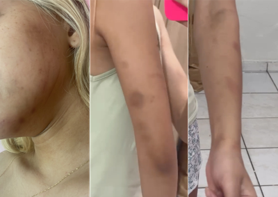 O caso aconteceu durante a madrugada deste s&aacute;bado (1&ordm;), em Coelho Neto. Imagens mostram diversas les&otilde;es pelo corpo da v&iacute;tima