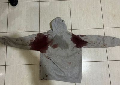 Ap&oacute;s esfaquear um jovem, suspeito tentou fugir de carro e atropelou um homem de 51 anos, que foi transferido inconsciente para Umuarama.