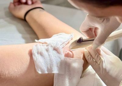Rede municipal passa a disponibilizar o implante subd&eacute;rmico e inicia compra do DIU hormonal.