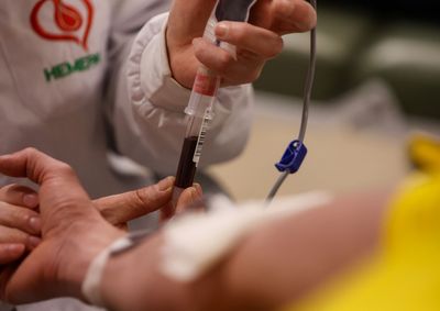 Entre as altera&ccedil;&otilde;es est&aacute; a redu&ccedil;&atilde;o do tempo de espera em algumas situa&ccedil;&otilde;es, como ap&oacute;s fazer tatuagem, colocar piercing, entre outros procedimentos.