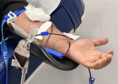 Atualiza&ccedil;&atilde;o das normas de hemoterapia altera prazos para doa&ccedil;&atilde;o ap&oacute;s procedimentos m&eacute;dicos e est&eacute;ticos e prev&ecirc; novas possibilidades para determinados grupo