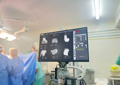 Tecnologia, de &uacute;ltima gera&ccedil;&atilde;o, permite maior precis&atilde;o cir&uacute;rgica, seguran&ccedil;a ao paciente e melhores perspectivas de recupera&ccedil;&atilde;o.