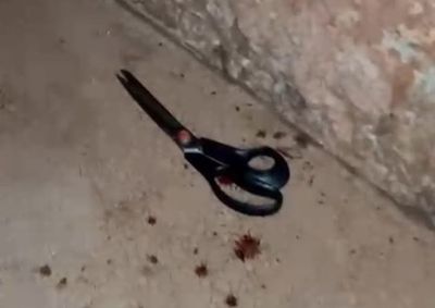 A suspeita teria cometido a agress&atilde;o por n&atilde;o aceitar o t&eacute;rmino do relacionamento.