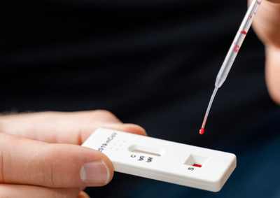 Exames podem ser realizados de forma sigilosa no SINAS, sem necessidade de apresentar sintomas.