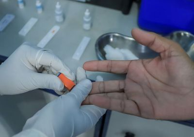 Capital contabilizou 3.061 casos at&eacute; setembro, com aumento de infec&ccedil;&otilde;es pelo tipo mais grave