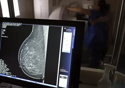 A cobertura desse exame alcan&ccedil;a mulheres entre 40 e 69 anos. Decis&atilde;o da ANS vale a partir de outubro