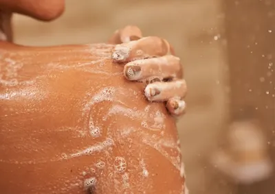 &Aacute;gua muito quente pode retirar a oleosidade natural da pele e aumentar o ressecamento; veja como evitar o problema nos dias frios.