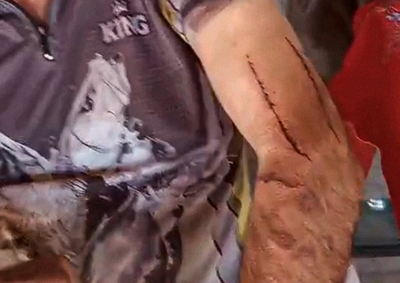 Idoso de 76 anos reagiu ao ataque de uma on&ccedil;a-parda e escapou com ferimentos; especialistas dizem que casos assim s&atilde;o extremamente raros