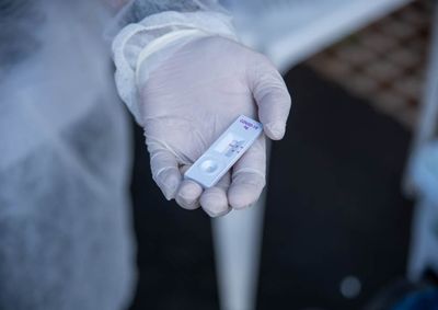 Há mais de quatro meses nenhuma pessoa da Capital da Amizade precisa ficar internada devido à doença