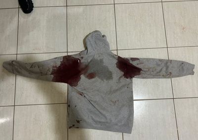 Crime come&ccedil;ou ap&oacute;s briga em bar no distrito de Paulist&acirc;nia; uma das v&iacute;timas sofreu ferimentos graves na cabe&ccedil;a e foi transferida inconsciente para Umuarama